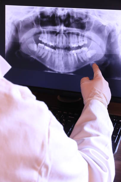 Best Emergency Broken Tooth Repair in Manitou Beach Devils Lake, MI