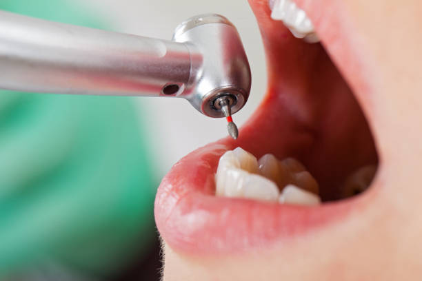 , MI Emergency Dentist Company
